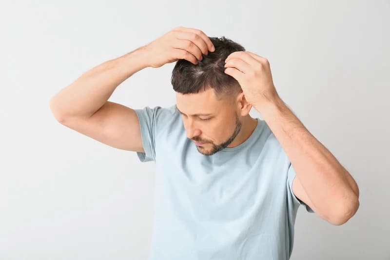Start a Discreet Hair-Loss Consultation
